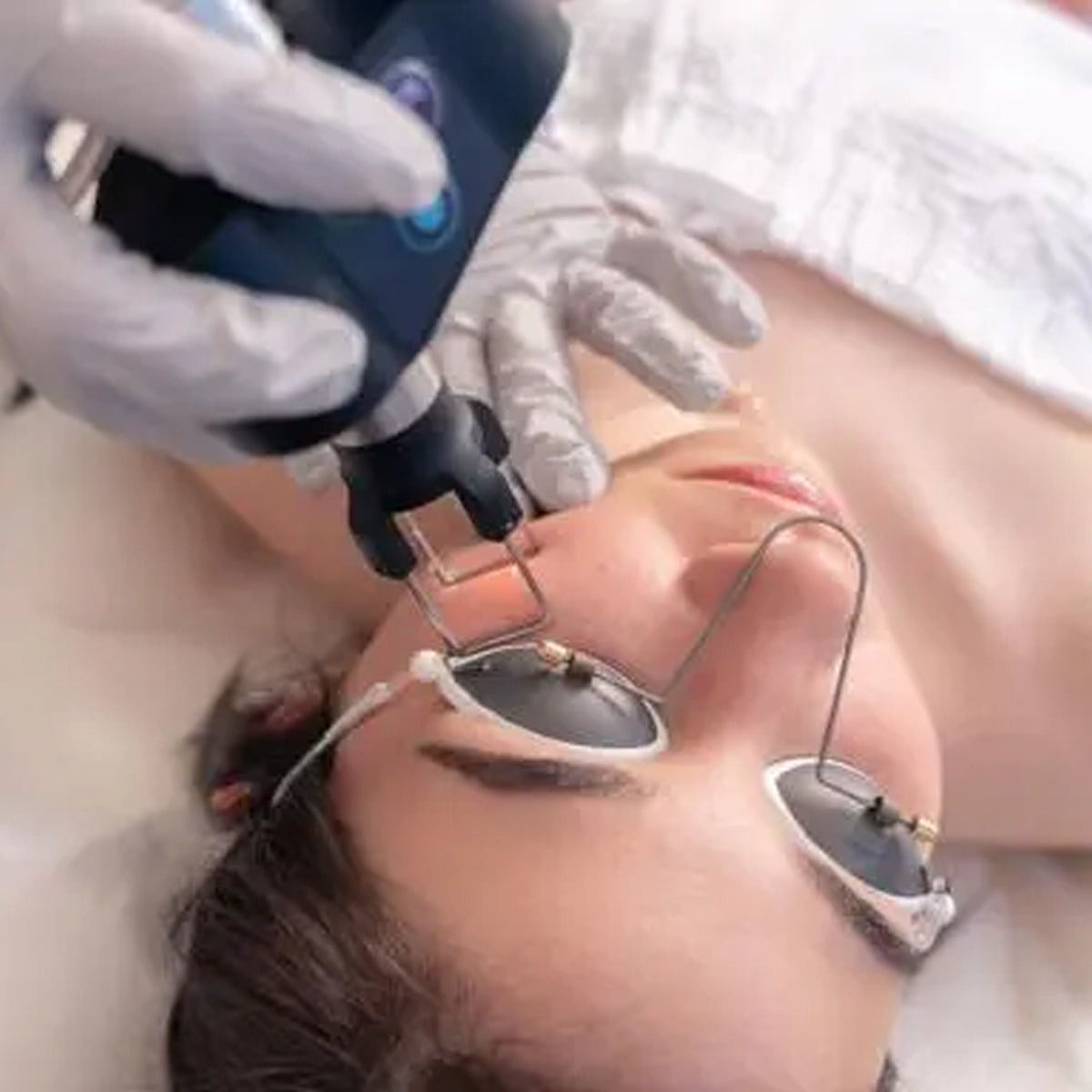 NoIR IShieldX Stainless Steel Eye Protection for all Light & Laser Patients